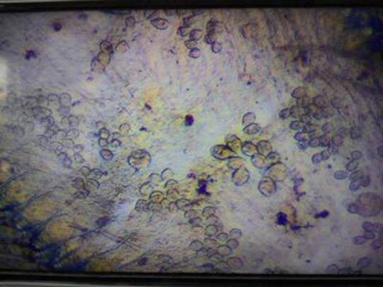 当前对虾、螃蟹最大的问题在纤毛虫，请尽快处理，否则高温/梅雨季悔之晚矣！